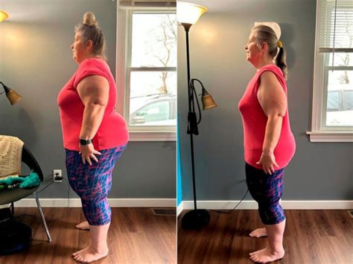 Alison Krauss: The Journey Of Weight Loss And Transformation