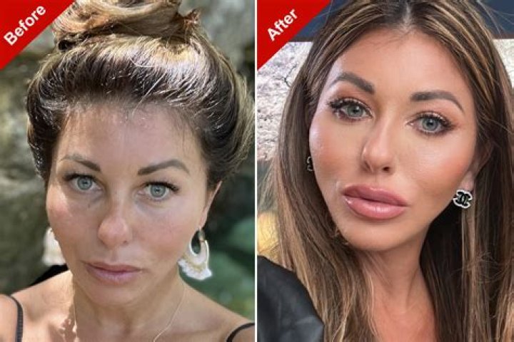 Exploring Alina Habba's Cosmetic Surgery Journey