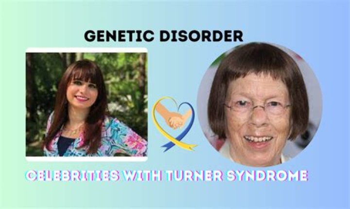 Famous Celebrities Who Have Overcome Turner Syndrome