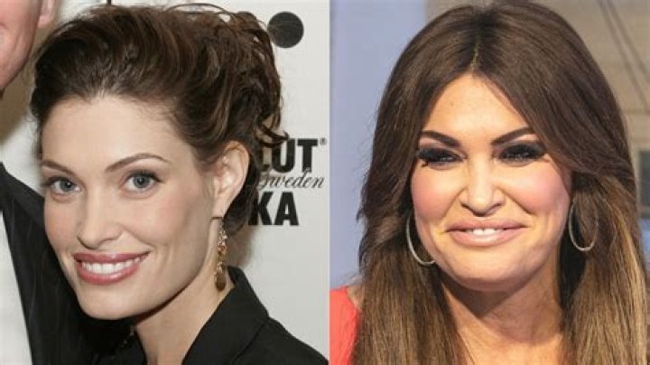 Guilfoyle Before Surgery: A Deep Dive Into Her Transformation Journey