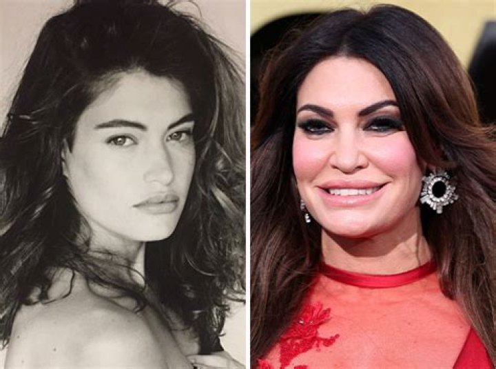 Kimberly Guilfoyle Before And After: Unveiling Her Transformation