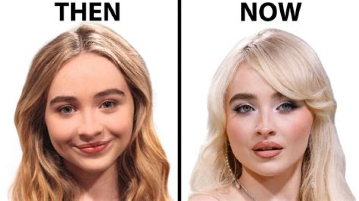 Sabrina Carpenter's Lip Injections: Are They Real Or Fake?