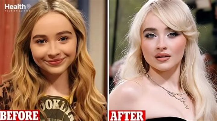 Sabrina Carpenter Before Surgery: A Glimpse Into Her Natural Beauty