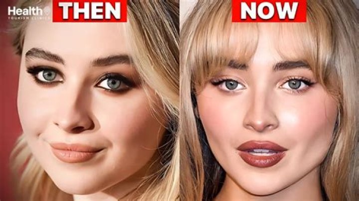 Sabrina Carpenter Plastic Surgery: A Complete Breakdown Of Her Procedures