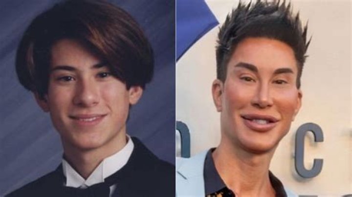 Transformations Of Justin Jedlica: A Look At His Journey Before And After