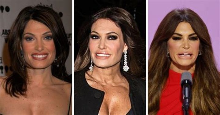 Unbelievable Transformation: Kimberly Guilfoyle's Plastic Surgery Journey