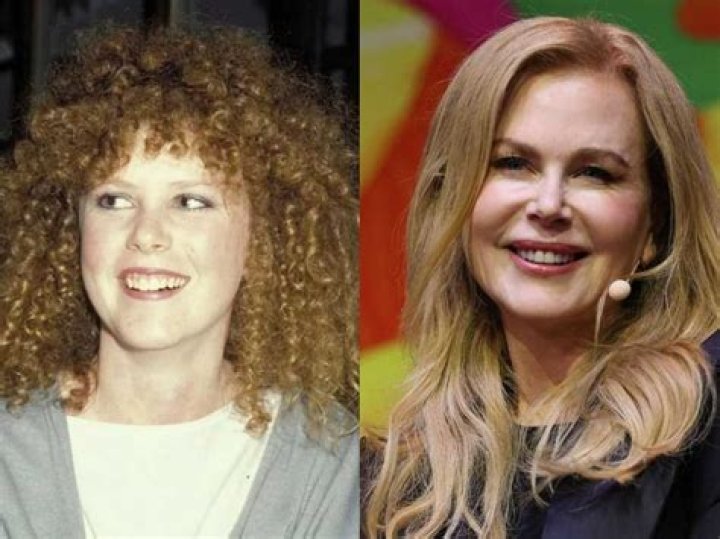 Uncovering Nicole Kidman's Surgery Secrets In 'The Undoing'