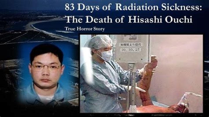 Unraveling The Tragic Tale Of Hisashi Ouchi And Radiation Exposure